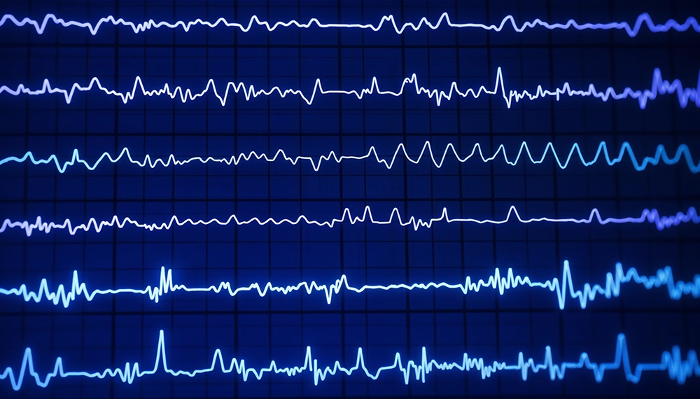 Clean Data Is Key: Real-Time Noise and Artifact Rejection